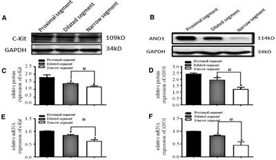 Downregulation of ICCs and PDGFRα+ cells on colonic dysmotility in hirschsprung disease